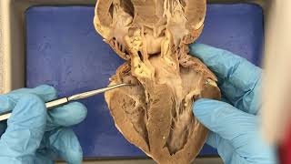 Sheep Heart and Model Anatomy Demo [upl. by Hgalehs359]