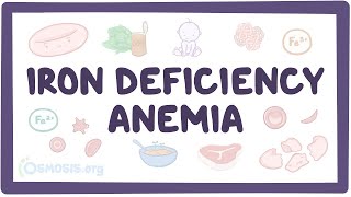 Iron deficiency anemia  an Osmosis Preview [upl. by Zinnes]