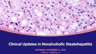 Clinical Updates in Nonalcoholic Steatohepatitis [upl. by Attenod637]