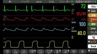 心電図モニター シュミレーション 安定 [upl. by Adnarym]
