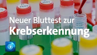 Früherkennung von Brustkrebs Forscher entwickeln Bluttest [upl. by Enelyt]