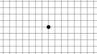 Amsler Grid [upl. by Alex]