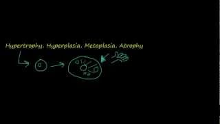 2  Introduction to pathology  hypertrophy hyperplasia [upl. by Annaiel]