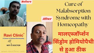 Malabsorption Syndrome and Its Homoeopathic Cure DrRavi Singh [upl. by Hairahcaz]