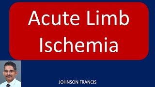 Acute Limb Ischemia [upl. by Adnahsor]