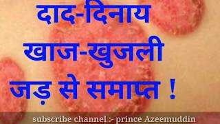 quadriderm rf cream use hindi  khujali ki cream  Prince azeemuddin [upl. by Gow]