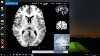 Dicom Image Viewer for Windows [upl. by Eddra54]