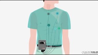 SCHILLER Holter Monitoring [upl. by Nahtannoj]