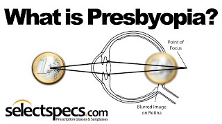 What is Presbyopia With SelectSpecscom [upl. by Merideth]