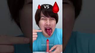 Big Injection Vs Small Injection Eating Challange🤣shortshumanitychallengeytshotstrendingviral [upl. by Brooks]