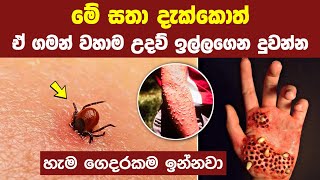 ලෝකයේ ජීවත්වන මාරාන්තිකම කෘමි සතුන් 07  07 Most dangerous bugs in the world [upl. by Nets]