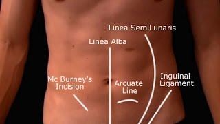 Appendicitis Ultrasound Lecture Version 01 [upl. by Fattal]