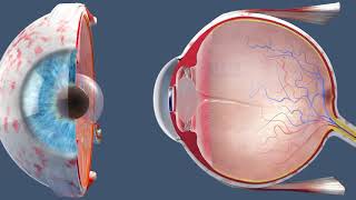 Cataract Surgery  Inside the OR [upl. by Christoph]