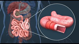 Comprendre L absorption intestinale  SVT [upl. by Yeclek1]