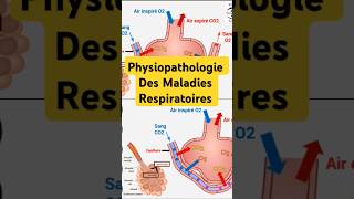 Physiopathologie Maladies Respiratoires pneumologie bronchite asthme fibrosepulmonaire poumon [upl. by Marysa]