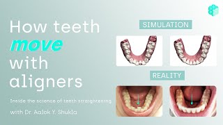 How teeth move with aligners  now explained [upl. by Nosnev]