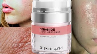 शुष्क त्वचा के लिए किस प्रकार का मॉइस्चराइजर सबसे अच्छा है Best ceramide moisturizer India  Unbox [upl. by Aprile]