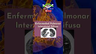 ENFERMEDAD PULMONAR INTERSTICIAL DIFUSA EN 1 Min salud medico doctor mrdoctor pulmones [upl. by Nnyla]