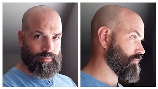 How I Trim a quotSummerquot Beard [upl. by Zabrine]