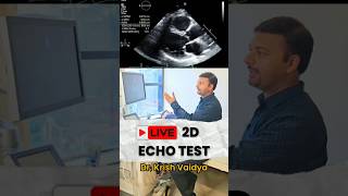 Live 2D Echo cardiography test heart echo live shorts shortsfeed short drkrishvaidya trend [upl. by Reeva]