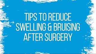 8 Tips to Stop Bruising After Insulin Injections [upl. by Derwood390]