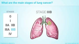 Staging of Lung Cancer [upl. by Essam101]