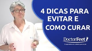 Calos e Calosidades  4 dicas IMPERDÍVEIS para prevenir e curar [upl. by Chesna]