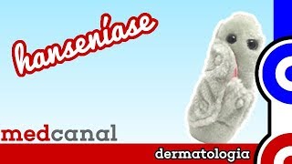 Hanseníase  DERMATOLOGIA [upl. by Willner]