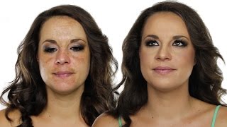 How To Cover Hyperpigmentation  Skin Pigmentation Using MakeUp  Shonagh Scott  ShowMe MakeUp [upl. by Arodnahs665]