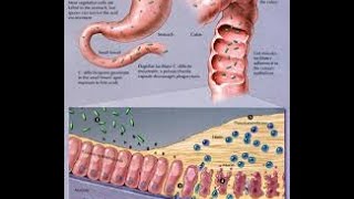 Clostridium Difficile [upl. by Eelegna187]