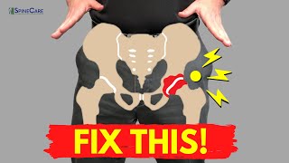 How to Fix a Popping Hip for Good NO EQUIPMENT [upl. by Dnaltiac]