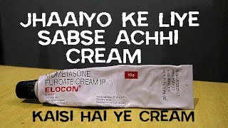 Elocon Cream Honest Review After Using 20 Days  Best Cream For Melasma In India [upl. by Hesky]