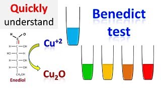 Benedicts test [upl. by Joab]