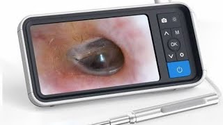 Otoscopio  endoscopio ótico WIFI RESEÑA Y UMBOXING ENDOSCOPE TOOL ANDROID [upl. by Allene]