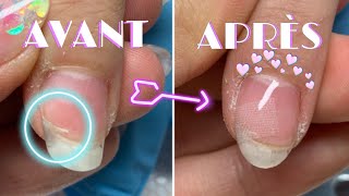 TUTO NAILS ⎥ Comment réparer un ongle fissuré ⛑ [upl. by Ahsilef]