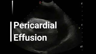 Vet Emergency Ultrasound Draining a Pericardial Effusion [upl. by Cochard353]