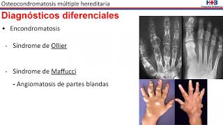 Osteocondromatosis múltiple hereditaria [upl. by Oliva]