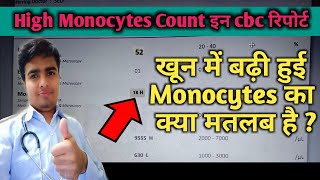 Monocytes High In Blood Test Monocytes In Hindi High Monocyte In Blood Cbc test [upl. by Tsui]