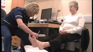 Diabetes Bites Diabetic Foot Examination [upl. by Airda115]