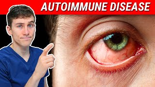 The SHOCKING Truth about Autoimmune Disease and Eye Health [upl. by Aniratac935]