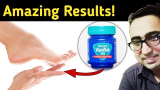 12 Unexpected Uses and Benefits of Vicks VapoRub You Must Know [upl. by Ranip365]