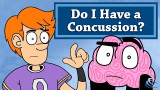 Do I Have a Concussion [upl. by Iila]