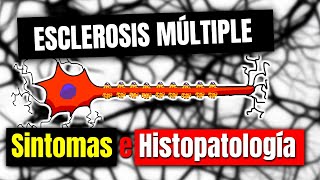 Esclerosis múltiple SINTOMAS E HISTOPATOLOGÍA  P2 [upl. by Yasnil]