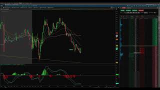 How to set a stop loss and limit sell simultaneously in Think or Swim [upl. by Nytsirc234]