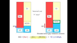 Metabolic Acidosis  Anion Gap  M Lam [upl. by Yeblehs]