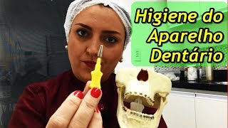 Como higienizar os dentes com aparelho ortodôntico [upl. by Rett]