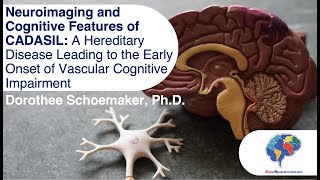 Neuroimaging and Cognitive Features of CADASIL [upl. by Osyth]