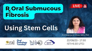 Harnessing the potential of mesenchymal stem cells in the treatment of Oral Submucous Fibrosis [upl. by Lerner]