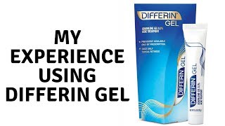 Review Differin Gel Adapalene 01 [upl. by Phelan]