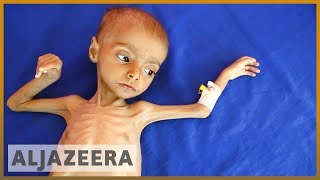 🇾🇪 19 million Yemeni children suffer malnutrition and illness l Al Jazeera English [upl. by Layman457]